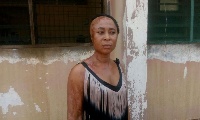 Mavis Frimpong suffered the acid attack in the hands of her husband
