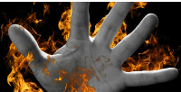 A 76-year-old man in Kwania District has died after setting himself ablaze