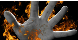 A 76-year-old man in Kwania District has died after setting himself ablaze