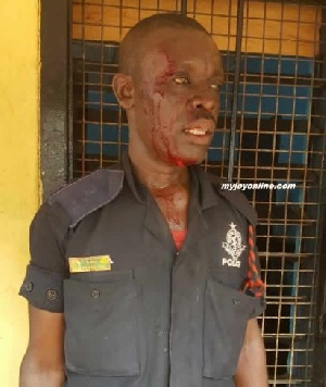 One of the injured policemen beaten by the soldiers