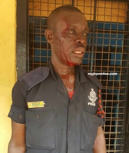One of the police officers beaten by officers of the Ghana Armed Forces in Tamale