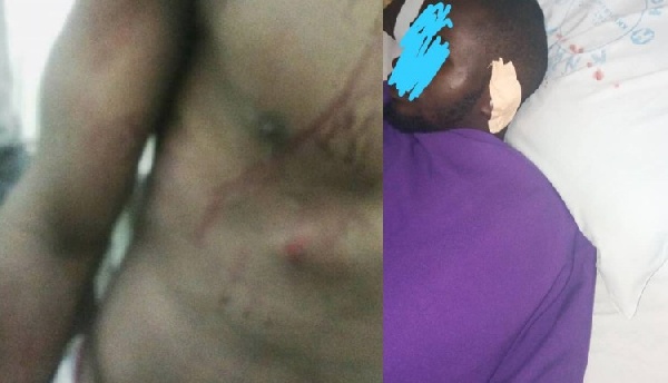 The third-year student who was brutalized by the school's security