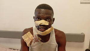 A tutor at the Ben Kunadu SDA Basic School,  Atsuvi Mawulor is seen siiting on his hospital bed
