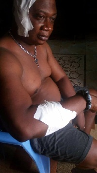 Ebenezer Osae Aryeh Wofa K also claimed that he was attacked by NPP activists.