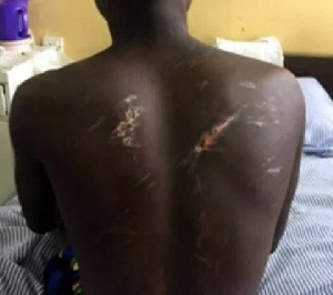 Christopher sustained severe injuries after the alleged brutality by the military personnel