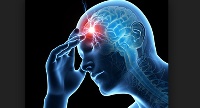 Stroke has become the leading cause of deaths at the hospital claiming 512 lives within 3 years