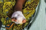 Mother apprehended following alleged mutilation of daughter’s toe