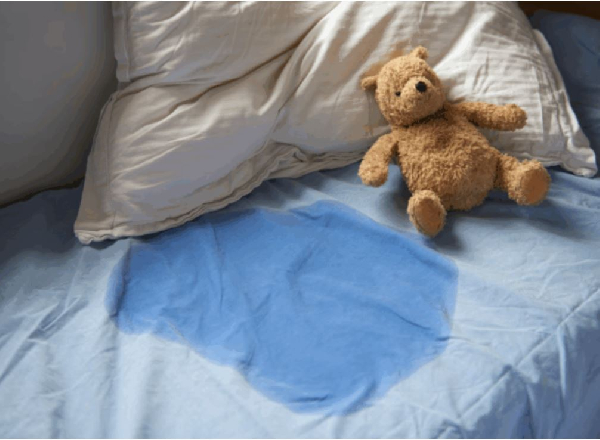 Case of guardian burning child over bedwetting reportedly withdrawn