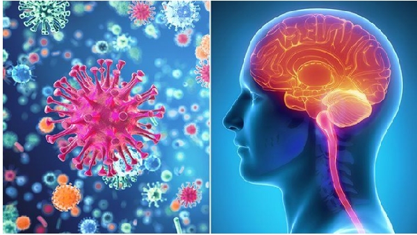 Meningitis causes inflammation of the outer layers of the brain and spinal cord