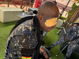 The police officer who was injured during the clash