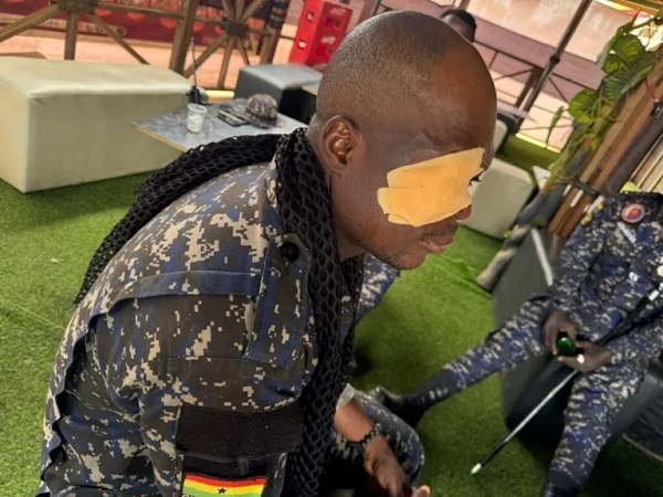 The police officer who was injured during the clash