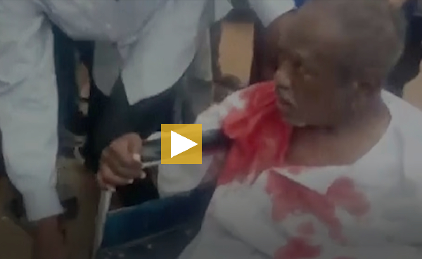 A patient is transported to the hospital in Khartoum, Sudan, on Monday, April 17, 2023