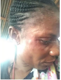 Theresa Bremansu was attacked by some fans of Prisons Ladies