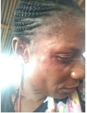 Referee Theresa Bremansu was beaten up by a Prisons Officer