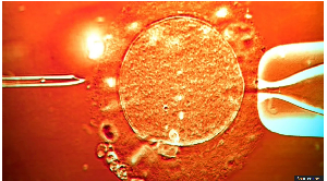 The donor's sperm was used in clinics across Europe (stock image)