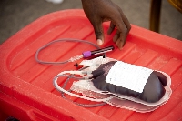 File photo of blood donation
