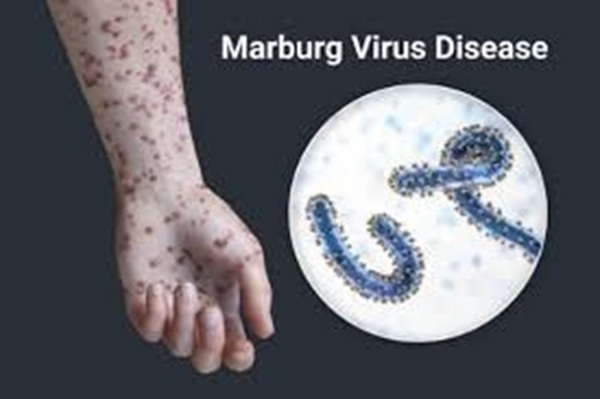 File photo showing the Marburg virus and the disease