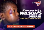 'When copper stays in your body' - Watch piece on Ghana's first Wilson’s disease victim
