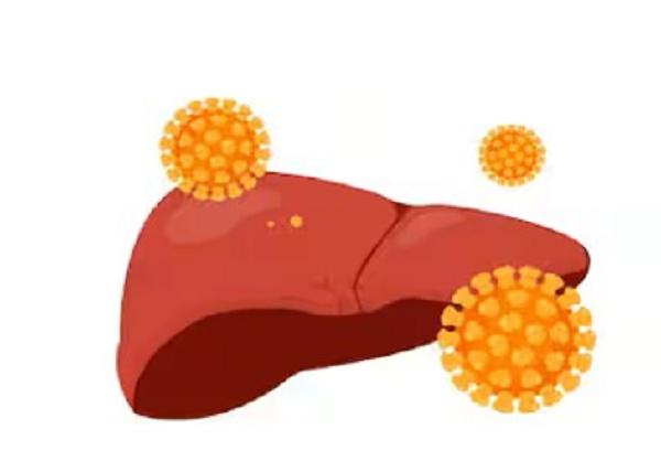 Hepatitis