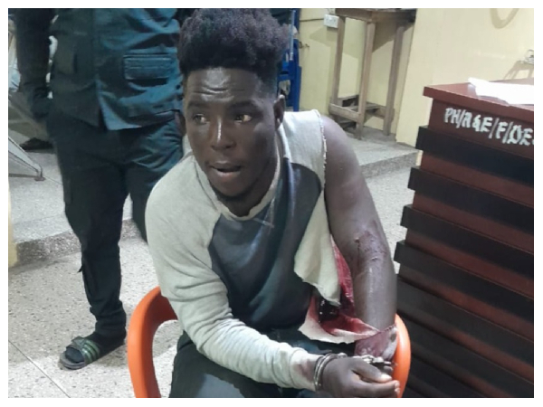 The suspect arrested with a gunshot wound