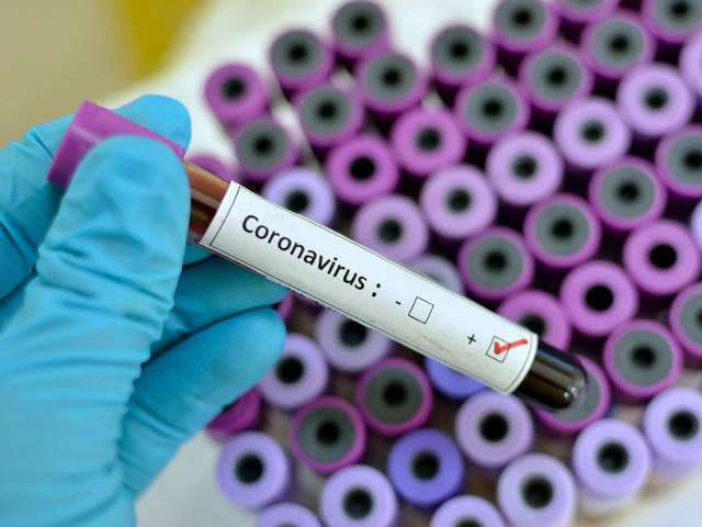 Ghana's coronavirus cases now dropping to fewer numbers