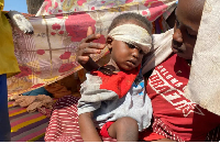A Sudanese child who fled el-Fasher city with family after the RSF takeover receives treatment