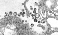 There have been outbreaks of Lassa Fever in some countries in the West Africa sub-region