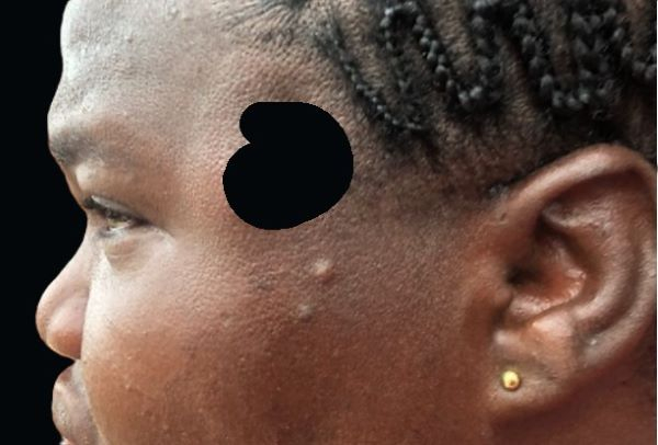 Health officials have described her condition as serious but stable