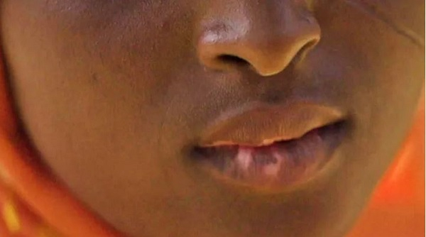 One of Fatima's daughters has marks on her lips as a result of using the creams