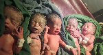 Ethiopian woman's joy at rare quintuplets after 12 years trying for a baby
