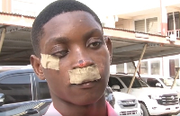 This Obrachire student was assaulted during inter-school activity in Agona Swedru