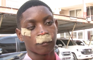 This Obrachire student was assaulted during inter-school activity in Agona Swedru This Obrachire student was assaulted during inter-school activity in Agona Swedru