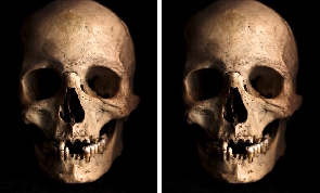 Vanderkindere canceled the auction of three African skulls -- Photo Credit: rawpixel.com