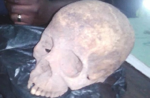 The two boys have denied ownership of the human skull