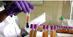 Laboratory technician tests blood samples