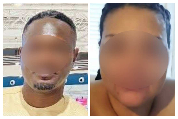 2 lovers arrested over setting apartment ablaze at Oyarifa Anointed Down