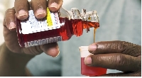 At least five African kontries don recall batches of Johnson & Johnson cough syrup