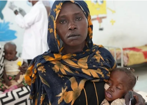 Manasek is suffering from severe malnutrition and her mother says food prices have soared