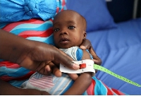 A MUAC tape used to screen malnutrition in children at the stabilisation ward