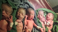 The quintuplets that were born to the woman
