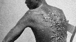 The story behind Gordon’s iconic photograph of slavery’s brutality