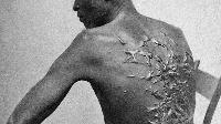 The scars are a reminder of how brutal slavery was