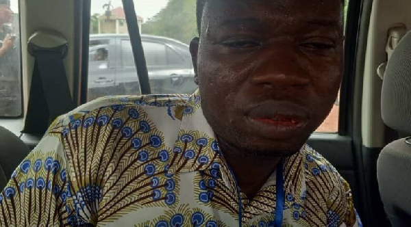 Gideon Peprah was assaulted by some unidentified men during the Council of State elections