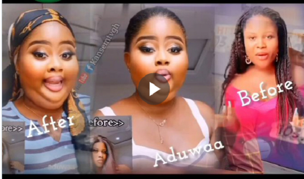 ‘I now look like a live-roasted pig’ – Lady cries over butt enlargement products