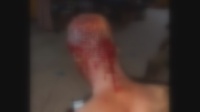 One of the victims with machete wounds in his head