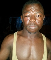 One of the victims of the Suhum clash