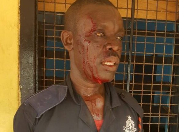 One of the injured police officer
