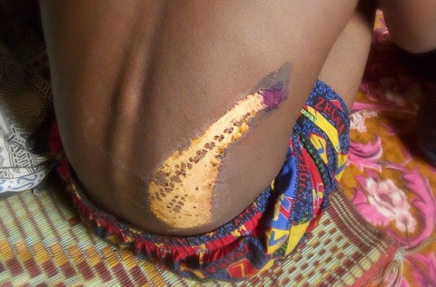 Tortured 15 year old