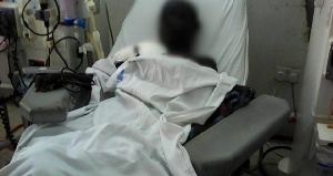 Dialysis patient | File photo