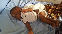 Doctors noticed a tumor on 10-month old Kofi Newland's spine just after birth